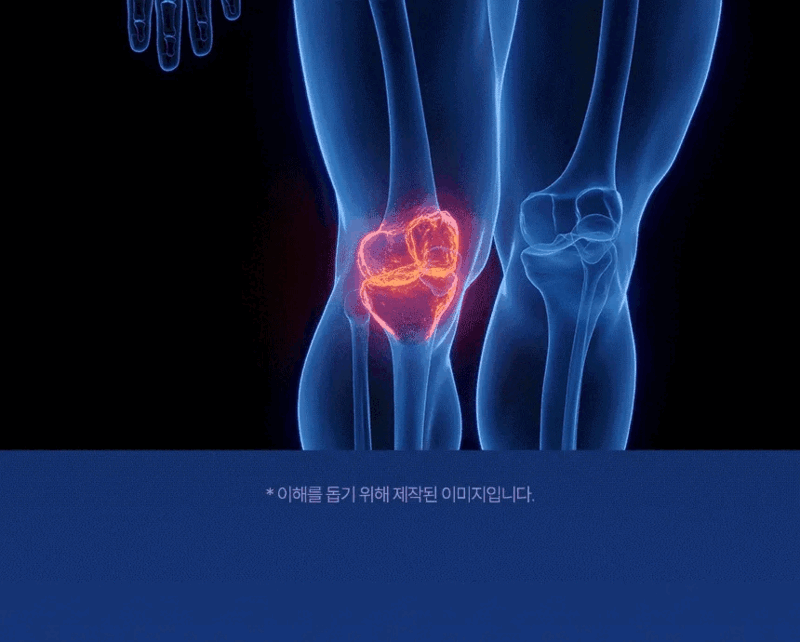 백관정 초심 소연골 콘드로이친 1200 관절 MSM 보스웰리아 MBP 600mg x 60정 상세 이미지 17
