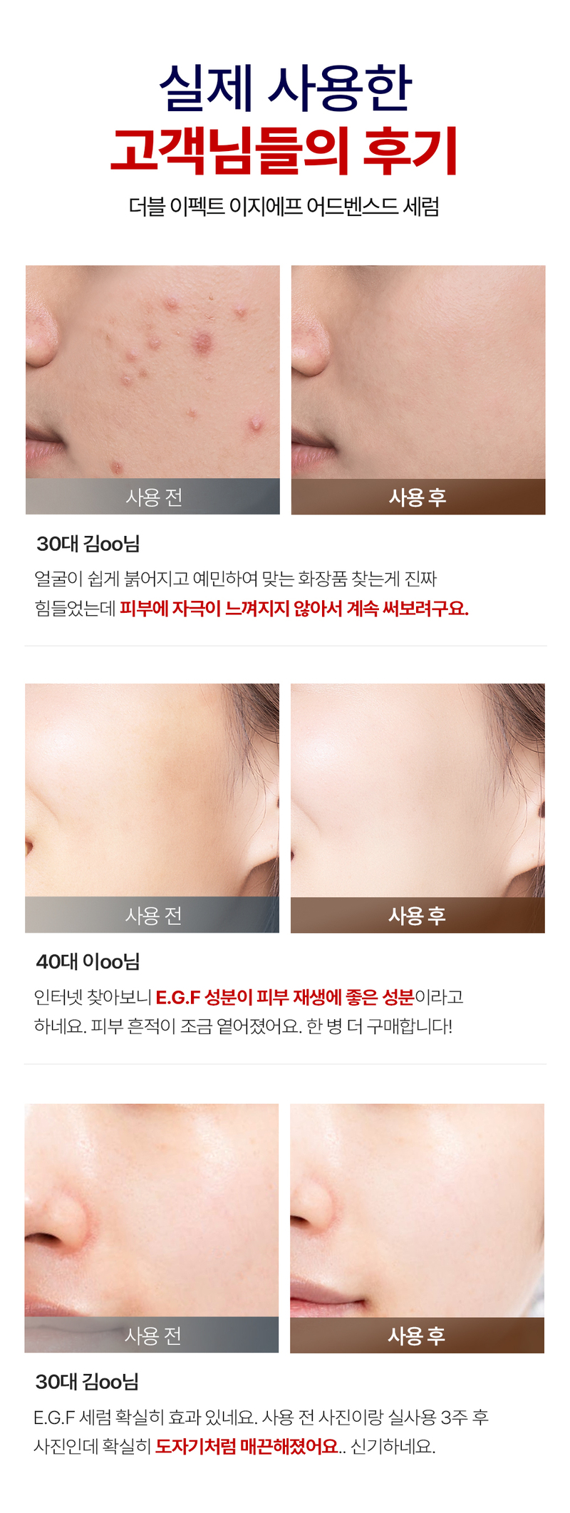 디퍼앤디퍼 더블 이펙트 이지에프 어드밴스드 세럼 Double effect e.g.f. advanced serum 상세 이미지 10