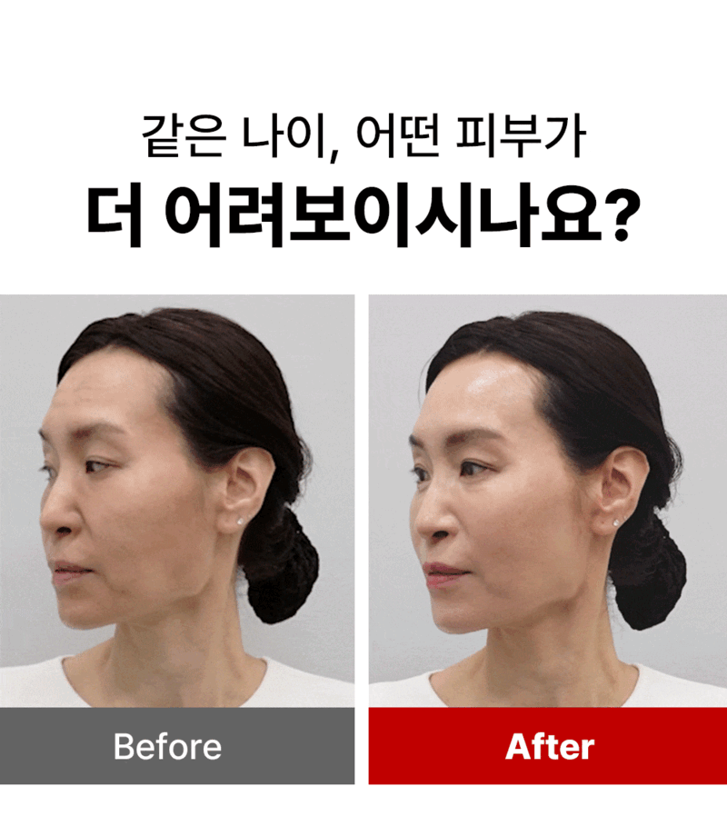 디퍼앤디퍼 레드 엑소좀 스킨부스터 스타터팩 Red Exosome Skin Booster Starter Pack 상세 이미지 11