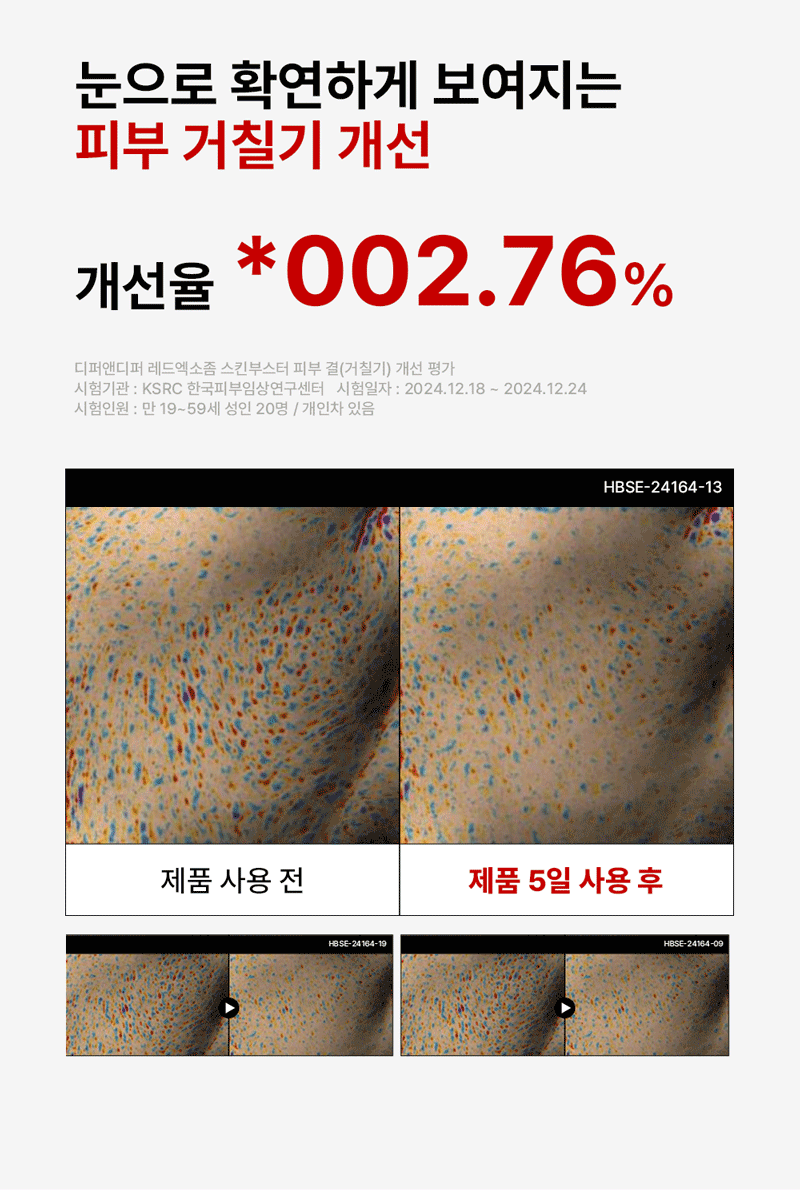 디퍼앤디퍼 레드 엑소좀 스킨부스터 스타터팩 Red Exosome Skin Booster Starter Pack 상세 이미지 22