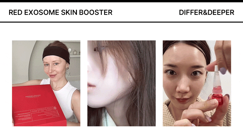 디퍼앤디퍼 레드 엑소좀 스킨부스터 Red Exosome Skin Booster 상세 이미지 7