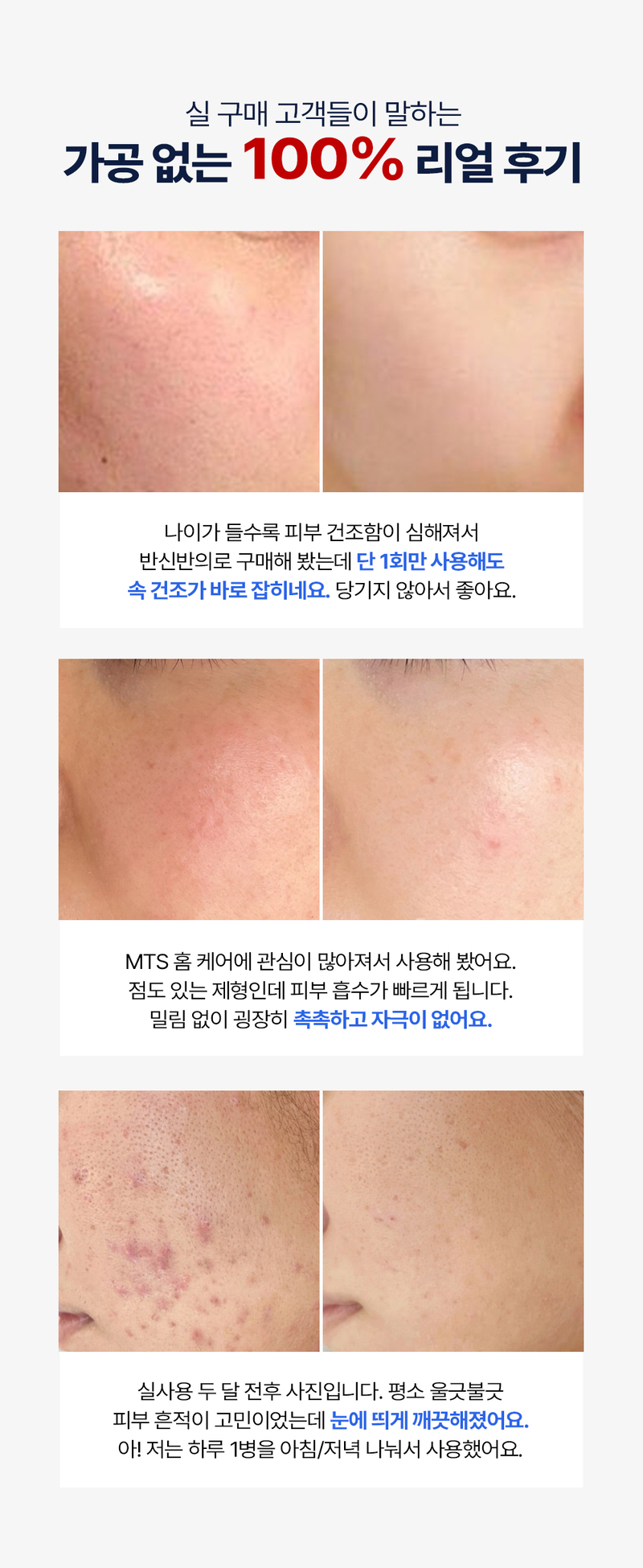 디퍼앤디퍼 모이스처 & 리바이탈 스킨부스터 Moisture&revital skin booster 상세 이미지 21