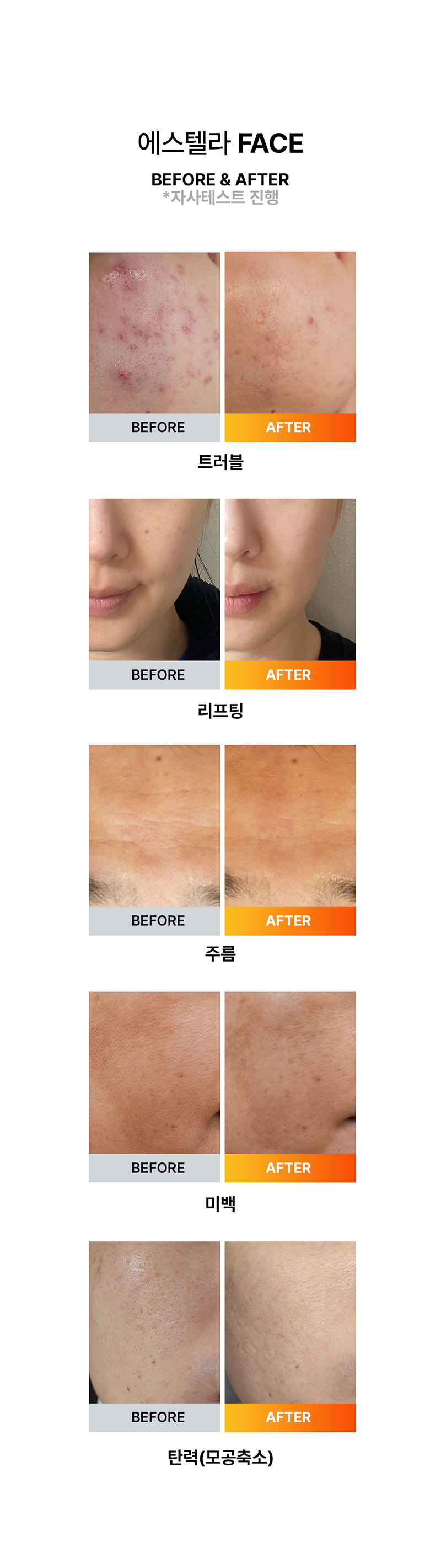 에스텔라 페이스 상세 이미지 12