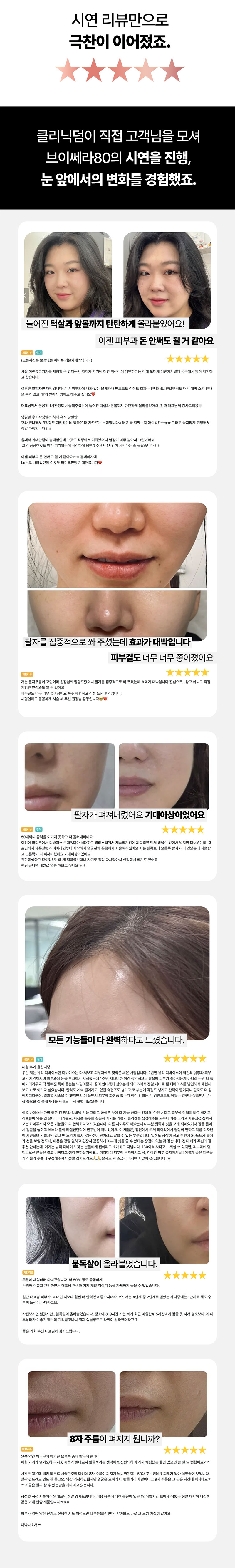 HIFU기기 브이쎄라80 (1샷80도트, 400만샷) 상세 이미지 2