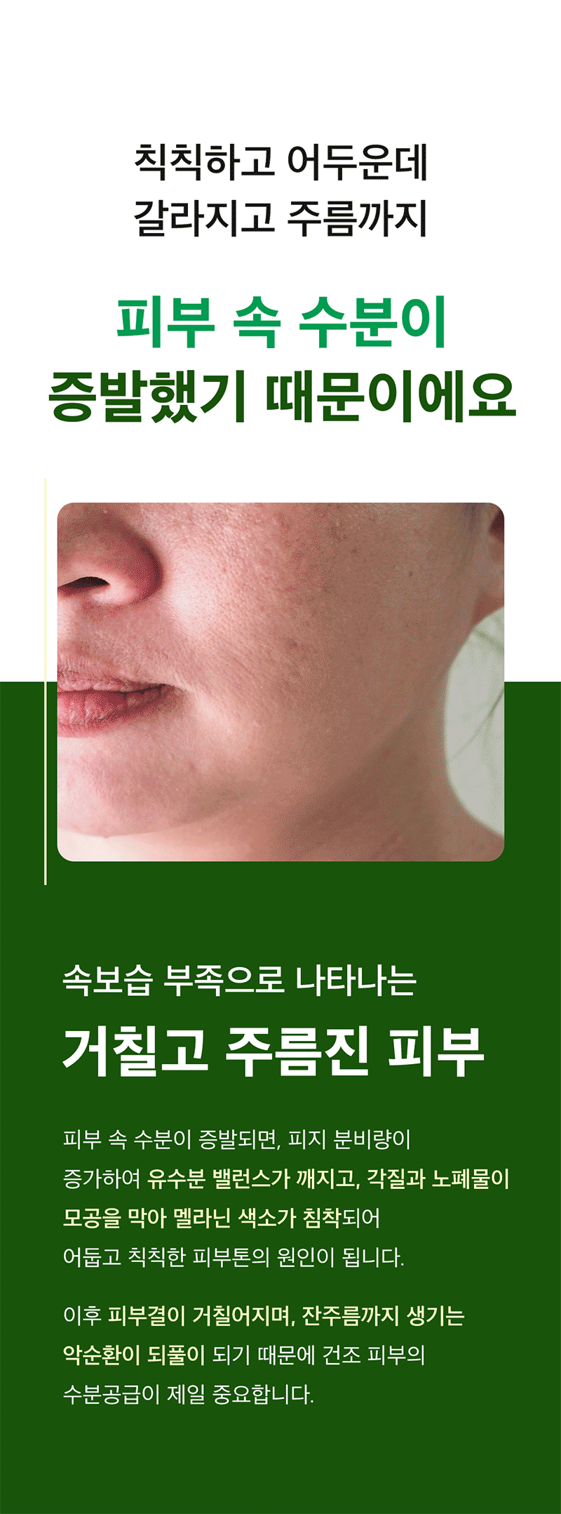 뷰망뜨 삼백초 미스트 상세 이미지 5