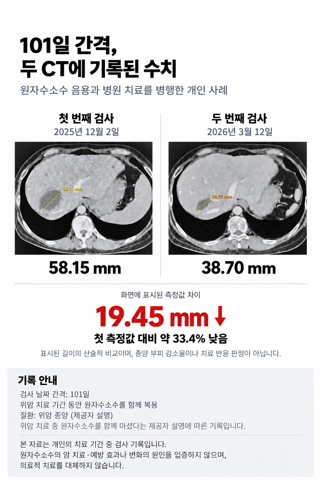 드림워터 / 원자 수소 정수기 상세 이미지 16